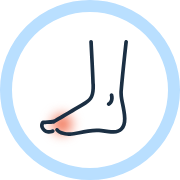 水虫・爪白癬・たむし